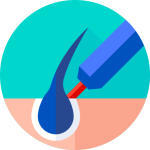 کاشت مو و مزوتراپی